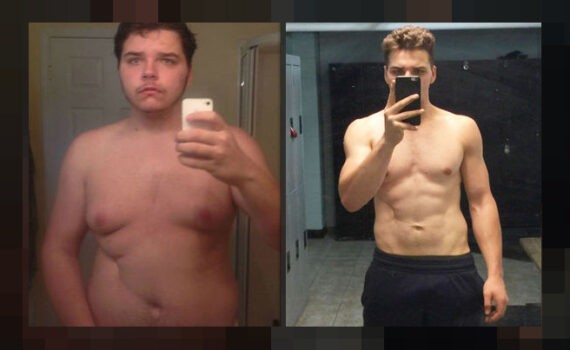 How To Tell If You Have Gynecomastia Or Just Fat