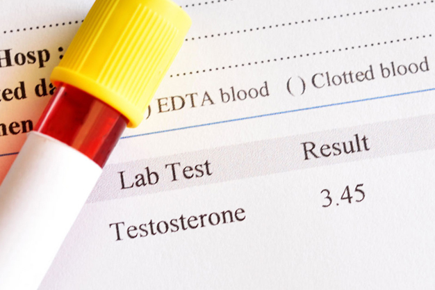 Blood Testing for Testosterone